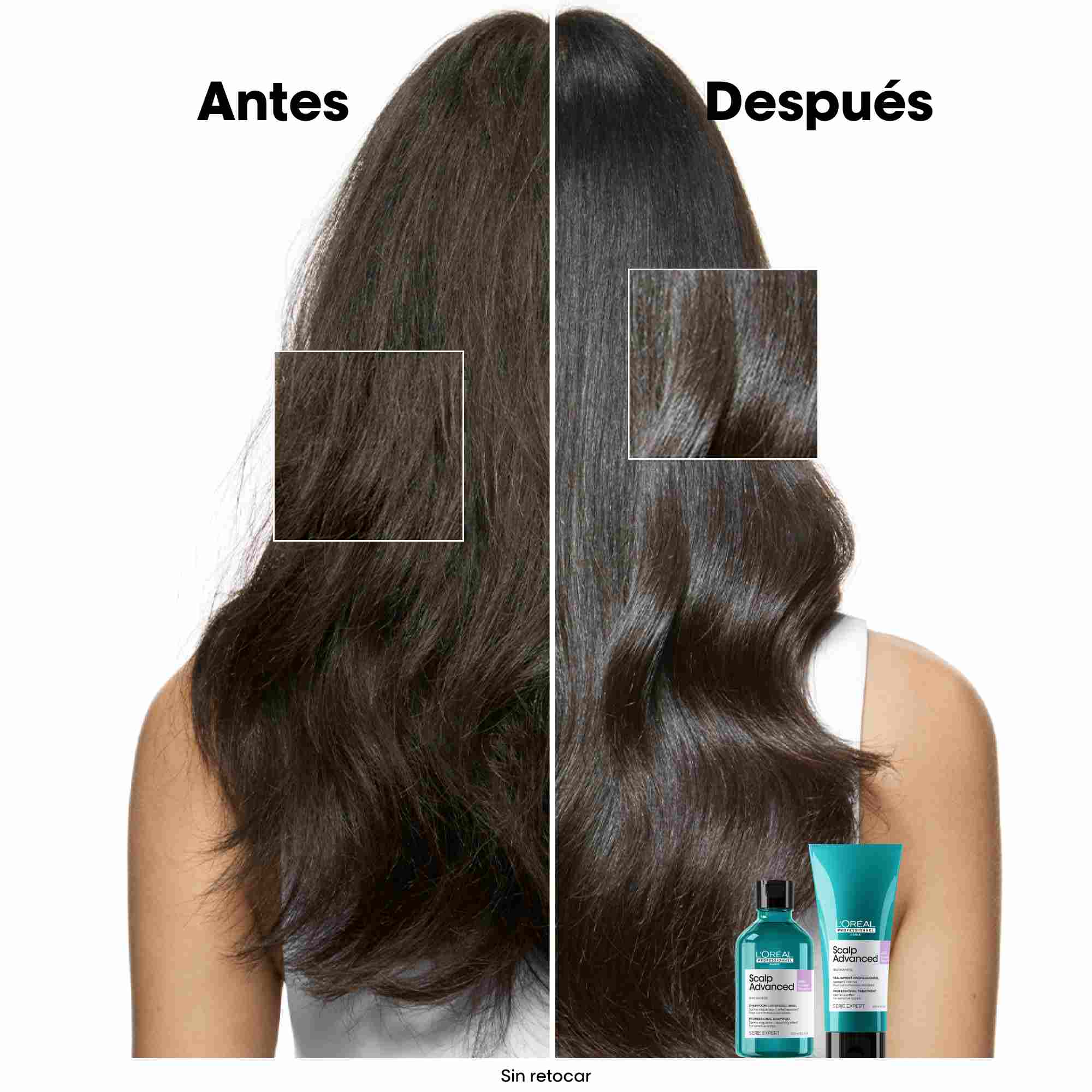 L'Oréal Professionnel Scalp Advanced Anti-Discomfort – Champú Calmante para Cuero Cabelludo Sensible