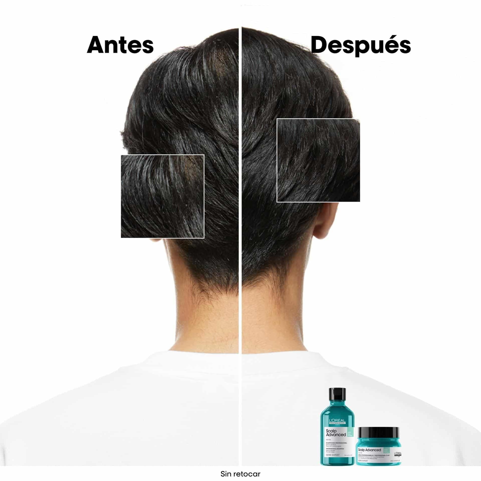 L'Oréal Professionnel Scalp Advanced Anti-Oiliness – Arcilla Purificante 2 en 1 para Cuero Cabelludo Graso