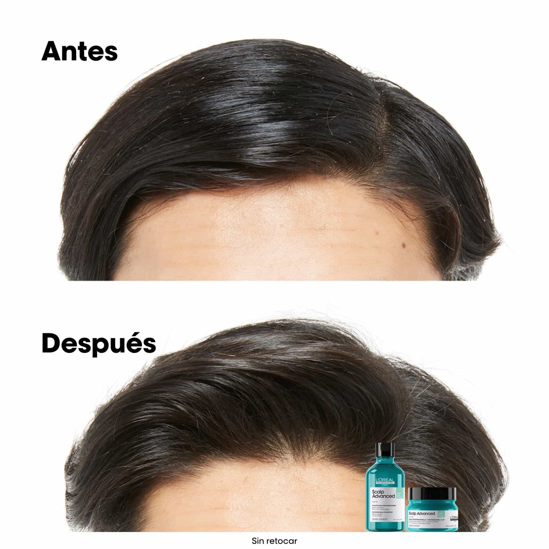 L'Oréal Professionnel Scalp Advanced Anti-Oiliness – Arcilla Purificante 2 en 1 para Cuero Cabelludo Graso