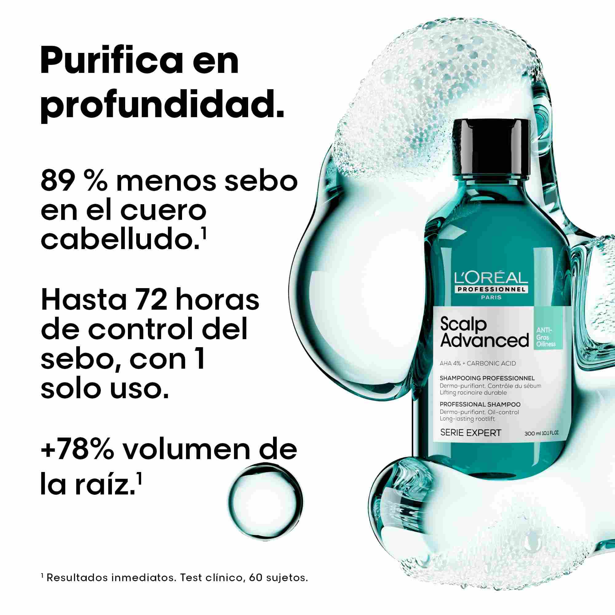 L'Oréal Professionnel Scalp Advanced Anti-Oiliness – Champú Purificante para Cuero Cabelludo Graso