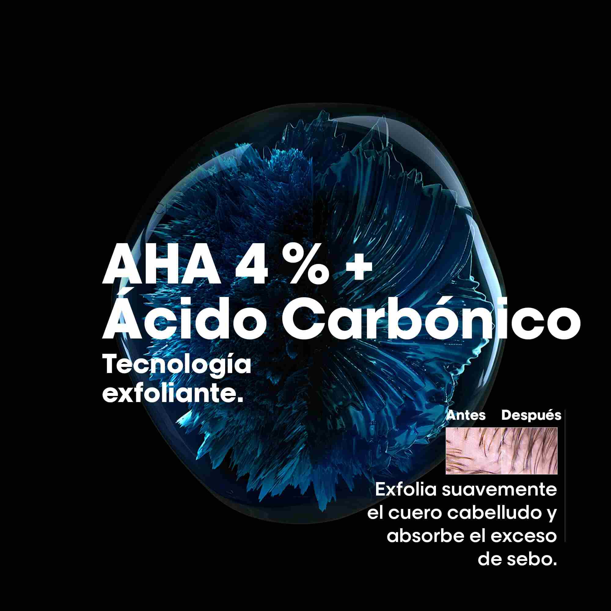L'Oréal Professionnel Scalp Advanced Anti-Oiliness – Champú Purificante para Cuero Cabelludo Graso